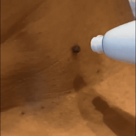 Hautpflege-Set – Entfernt Hautanhängsel sicher & effektiv, komplett Set für glatte, gepflegte Haut